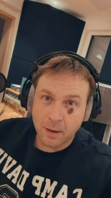 🎅 AM SAMSTAG DEN 06.12 LIVE 🎙️IN DER KIEZ ALM HAMBURG @tobee_official 🤩 MIT UNSEREN 2 ADVENT ABRISS 🍺🎄SICHERT EUCH JETZT DAS GOLDENE TICKET AUF UNSERER WEBSEITE www.KIEZ-ALM.de UM GARANTIERTEN EINLASS ZU HABEN 🎫
@dj_cashi_offiziell extra angereist aus dem @bierkoenigmallorca wird alles geben um Euch zu Unterhalten und gemeinsam die Alm zum WACKELN bringen !
Wir freuen uns auf Dich!
WIR SIND PARTY ❗️
KOMM IN DEINEN #lieblingsclub
#kiezalmhamburg #kiezalm #großefreiheit #reeperbahnhamburg #kiez #hamburg #wirsindparty #hamburgerkiez #saufisaufi #wirsindmalle #wirsindparty #malle #mallorcaparty #mallorcapartysdeutschland #abfahrt #hamburgmeineperle #partybiszumabwinken #sangria #mallefieber #party #partyhard #abriss #saufisaufi #moinmoin #bierkönig #partyhamburg